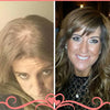 vivir-con-alopecia
