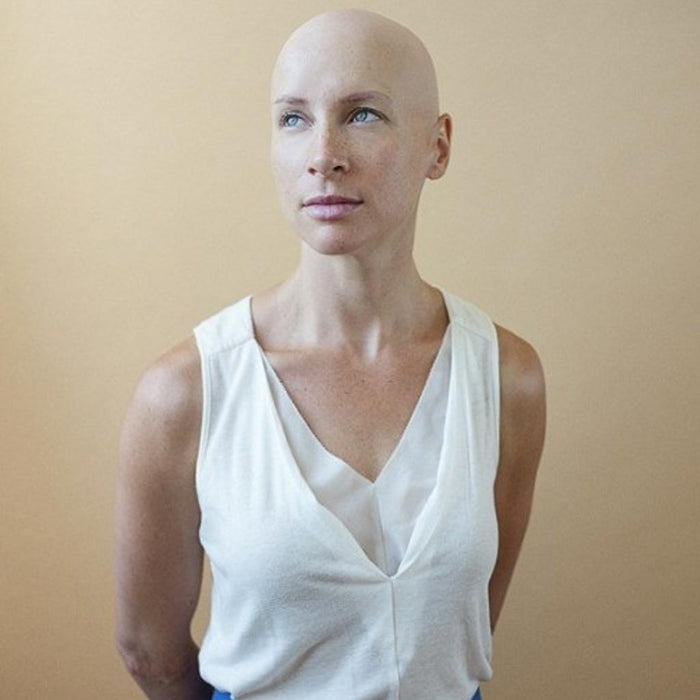 Un llamado a la conciencia: la ALOPECIA no es una enfermedad